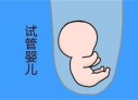 培养金华捐卵宝宝艺术细胞的小技巧